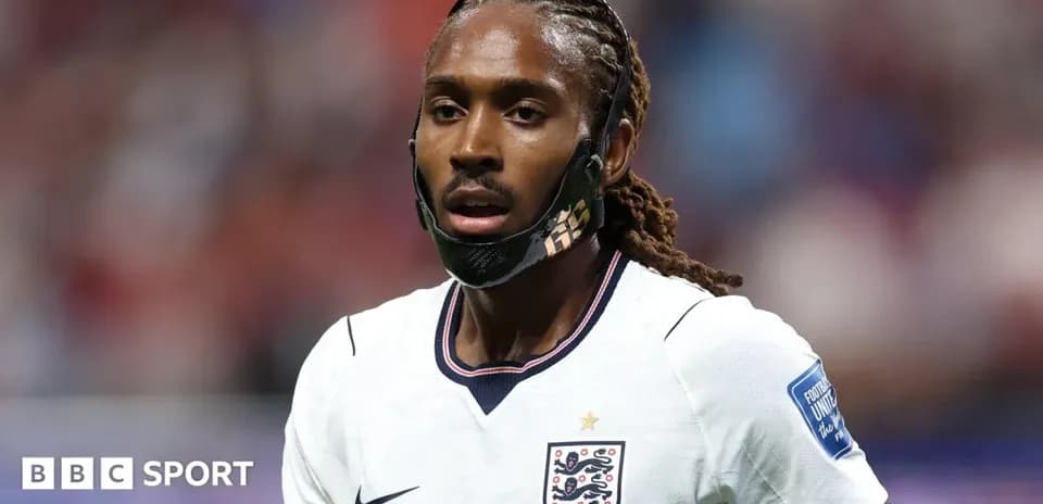 Jugador de Inglaterra con máscara durante el partido