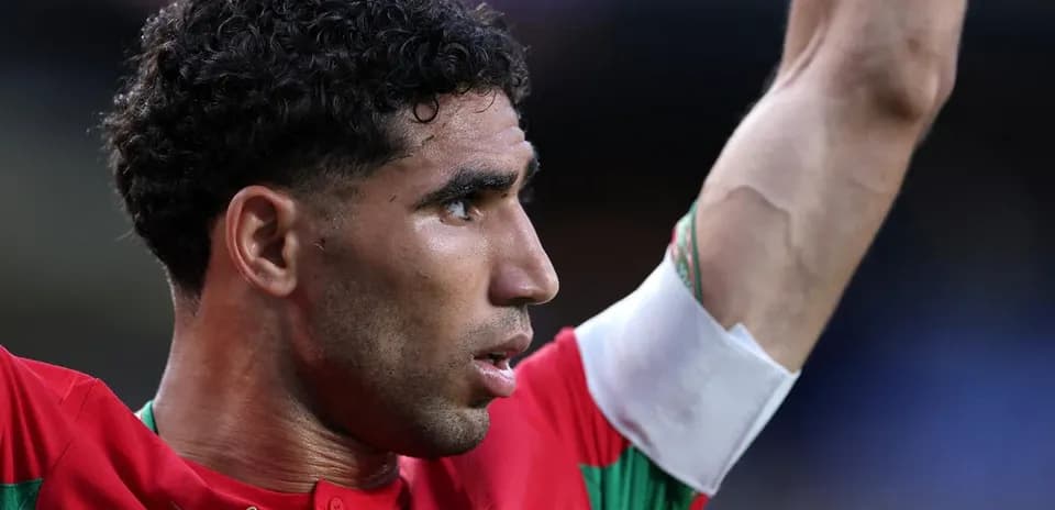 Jugador levantando el brazo durante un partido