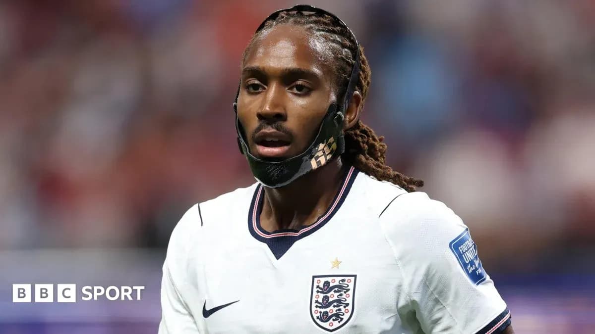 Jugador de Inglaterra con máscara durante el partido Jugador de Inglaterra con máscara durante el partido